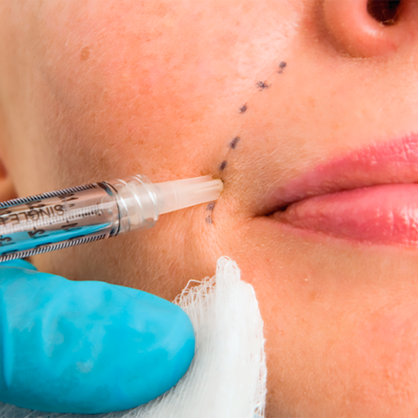 dermal fillers 1600x900 (1)